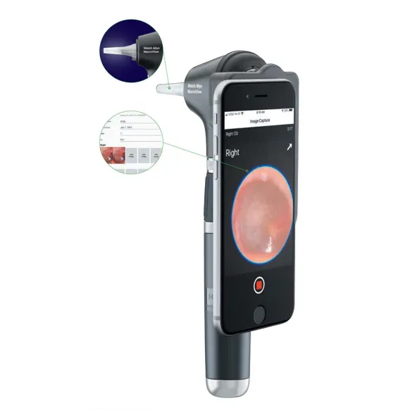16696 - Otoscope - Taille unique